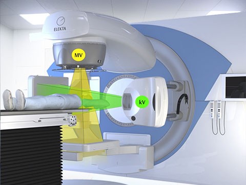 CBCT 位置驗(yàn)證系統(tǒng)